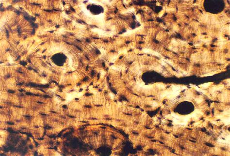 COMPACT BONE HISTOLOGY | Microanatomy Web Atlas | Gwen V. Childs, Ph.D.
