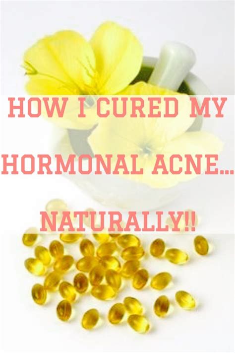 How I Cured My Hormonal Acne Naturally Hormonal Acne Natural Acne