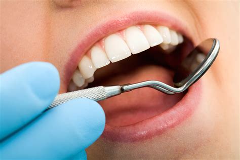 What Is Dental Plaque Olney Dental Center