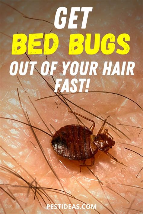 Get Bed Bugs Out Of Your Hair Fast Rid Of Bed Bugs Bed Bugs Diy