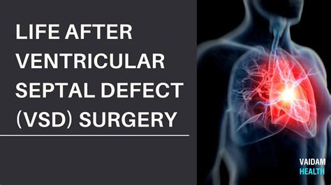 Life After Ventricular Septal Defect Vsd Surgery Youtube