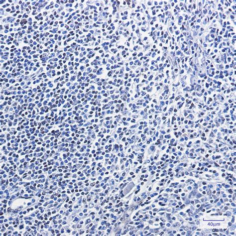 high affinity and specificity recombinant hmgb1 monoclonal antibody e ab 81436 at