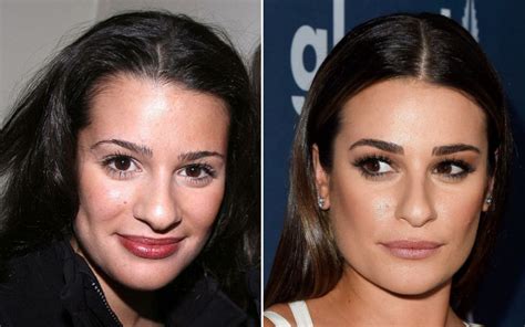glee actress lea michele plastic surgery before and after
