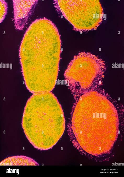 Streptococcus Pneumoniae Coloured Transmission Electron Micrograph