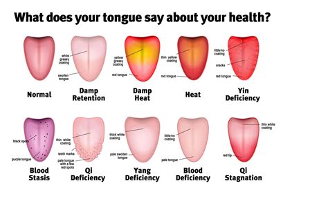 Tongue Says About Your Health 1