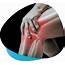 Albuquerque Joint Pain Clinic Knee & Shoulder Treatment Dr Raiten