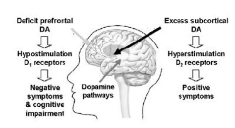 2 Dopaminergic Imbalance In Schizophrenia Alteration In Cortical Da