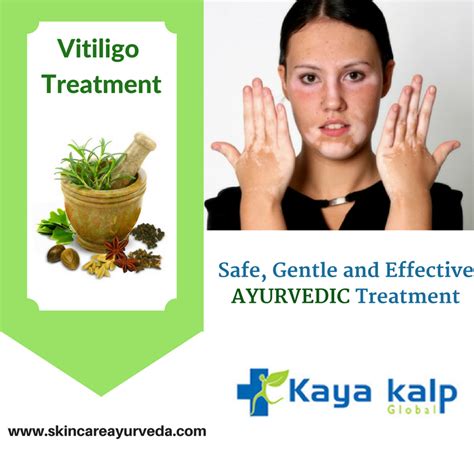 Ayurvedic Vitiligo Treatment In India Kayakalp Global Is A Leading