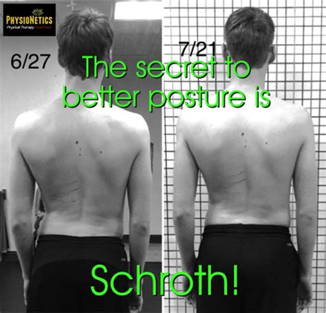 Treating Scoliosis Schroth Therapist Florida Physical Therapists Physionetics The Leading