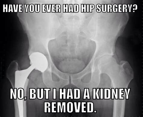 13 Conditions That Mimic Fibromyalgia Radiology Humor Medical Humor