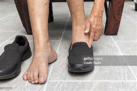 Elderly Woman Varicose Veins Feet Puts On A Shoes At Home High Res