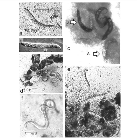 Developmental Stages Of Dirofilaria Repens In Aedes Japonicus Collected