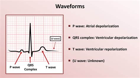 Intro to EKG Interpretation - Waveforms, Segments, and ...