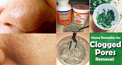 Top 12 Home Remedies For Clogged Pores