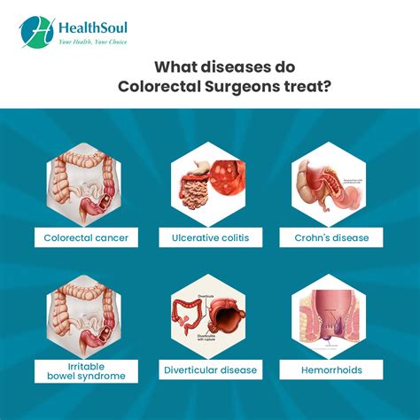 Learn About Colorectal Surgeons Diseases They Treat And When To See