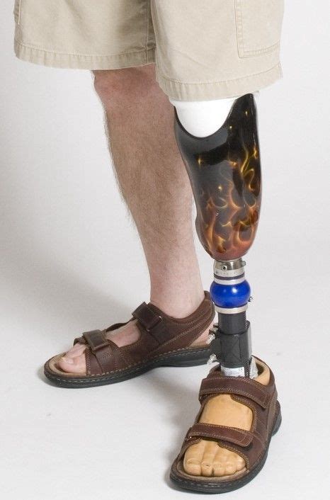 Flame Painted Prosthesis Orthotics And Prosthetics Medical Shoes