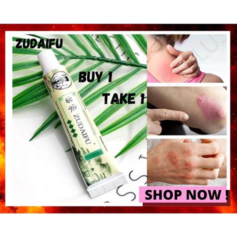 buy 1 take 1 zudaifu chinese herbal skin psoriasis cream dermatitis eczematoid eczema 15g