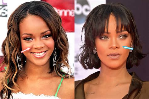Rihanna Plastic Surgery Before After Telegraph