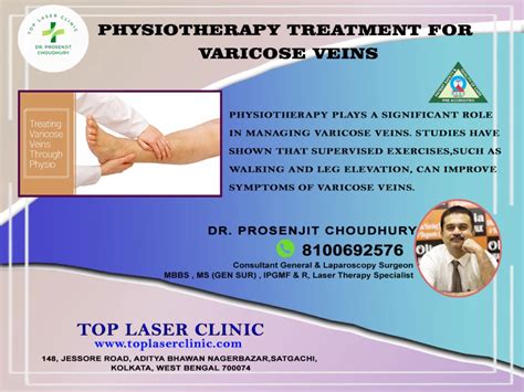 Physiotherapy Treatment For Varicose Veins Top Laser Clinic