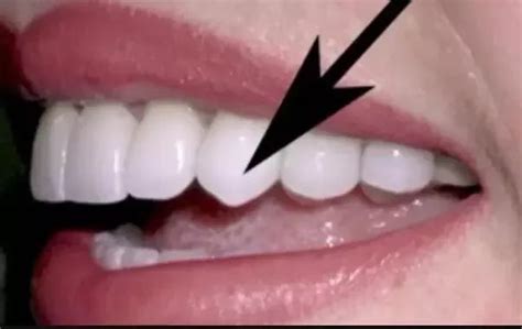 Bts As Types Of Teeth Armys Amino