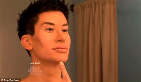 Man Spends 100000 On Nearly 100 Plastic Surgery Operations To Become Real Life Ken Doll