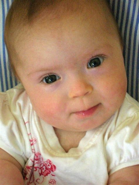 What To Say When A Baby Is Born With Downs Syndrome Down Syndrome