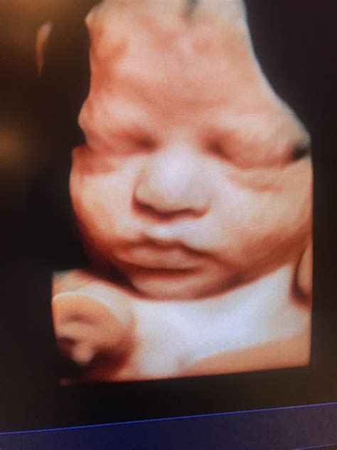 3d/4d ultrasound, 2769 coney island ave, brooklyn, ny 11235. Baby's Close-up Gallery in Jacksonville, Florida