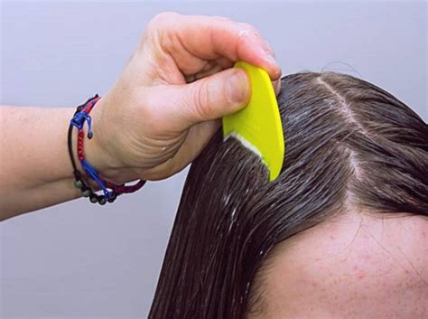Cara Mematikan Kutu Rambut » WebsiteRiau.co.id