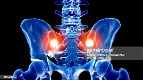 Sacroiliac Pain Photos And Premium High Res Pictures Getty Images