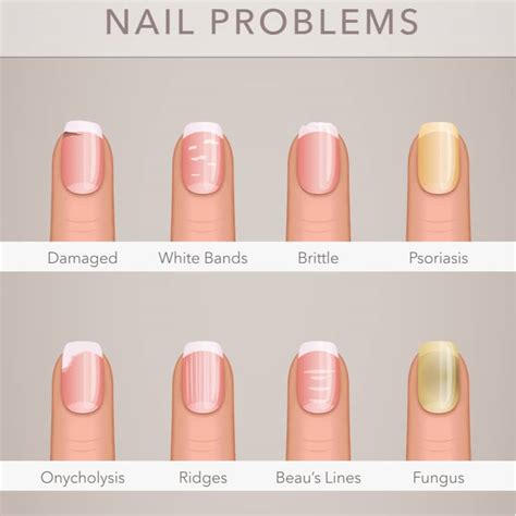 10 Nail Problems You Should Not Ignore Medic Drive