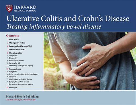 Ulcerative Colitis And Crohns Disease Harvard Health
