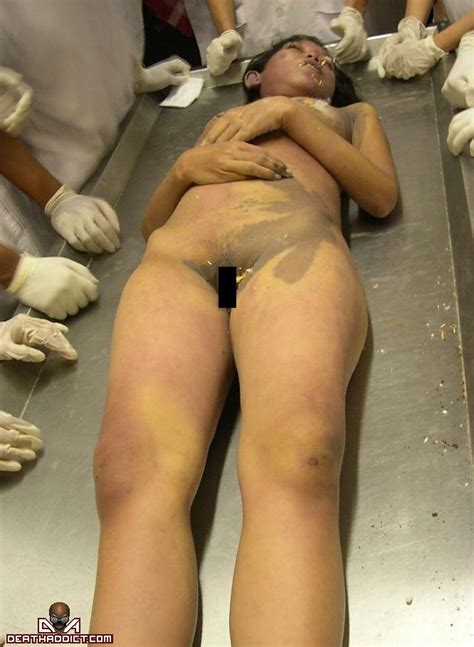 Autopsy Nude Pics Page Sexiezpicz Web Porn