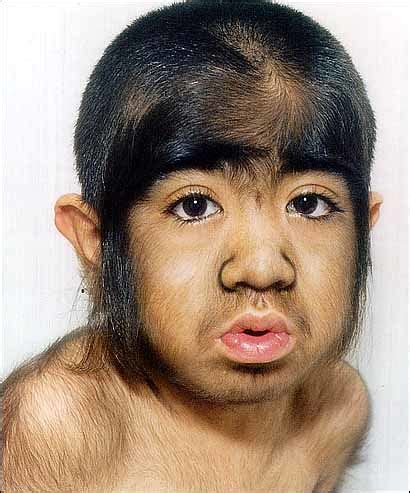 Hairy Chinese Kid Sierraistasty Flickr