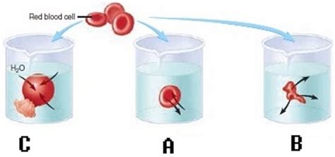 Red Blood Cells Rbcs Have Been Placed In Three Different Solutions