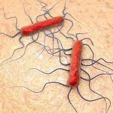 Listeria Infection Listeriosis Causes Types Symptoms Diagnosis