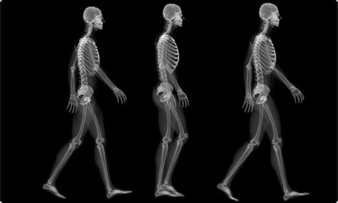 Huesos Largos ¿qué Son Anatomía Función Características Y Más