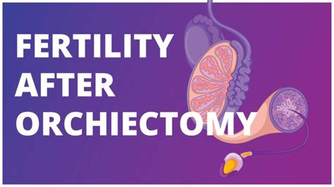Fertility After Orchiectomy Effects Of Surgery Chemotherapy And