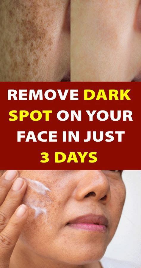 in just 3 nights remove dark spots on your face naturally remove dark spots beauty skin