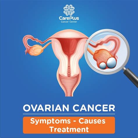 Ovarian Cancer Symptoms Causes And Treatment