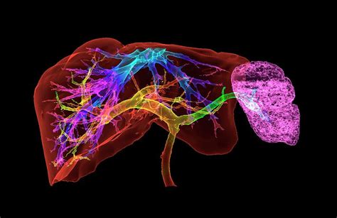 Liver And Spleen And Blood Vessels Photograph By K H Fungscience Photo