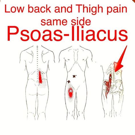 Adbucts the thigh at the hip joint. The iliopsoas muscles or primary hip flexors are commonly aggravated in runners. If stretching ...