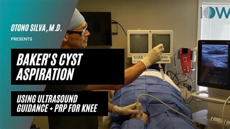 Bakers Cyst Aspiration Prp Youtube