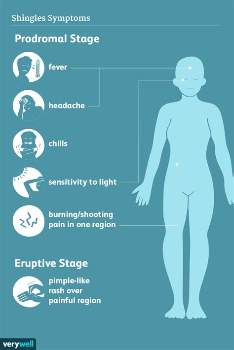 Shingles Signs Symptoms And Complications