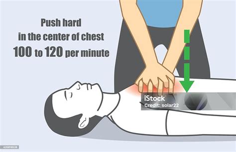 Hand Push Hard And Fast In The Center Of Chest Stock Illustration