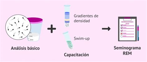 Qu Es El Seminograma Y Cu Ndo Se Considera Normal