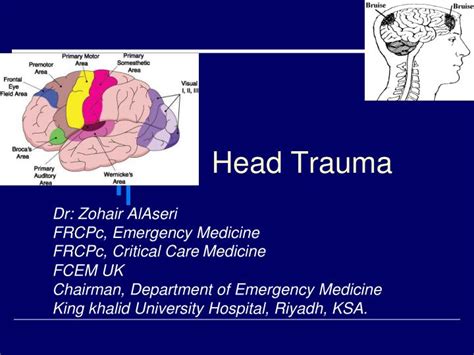 Ppt Head Trauma Powerpoint Presentation Free Download Id5370957