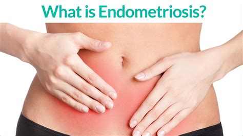 Endometriosis Study Unlocks Path To Understanding Endometriosis