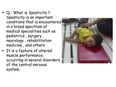 Ppt Spasticity And Increased Muscle Tone Powerpoint Presentation