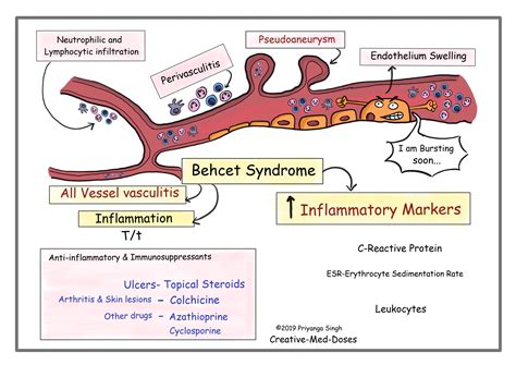 Behcet Syndrome Ulcers Blindness And Vasculitis Creative Med Doses