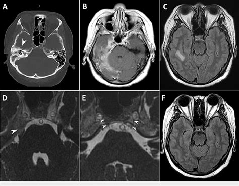 Brain Computed Tomography Ct Scan And Magnetic Resonance Imaging